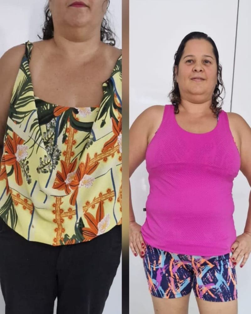 Antes e depois de Paciente da Alyne, 40+